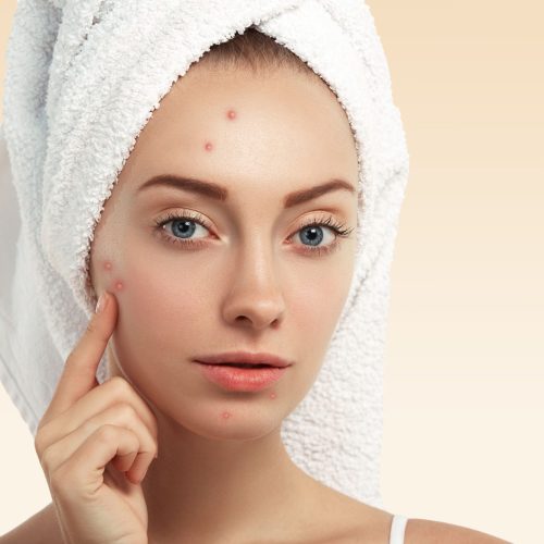 Dark Spot Remover for Face in Hyderabad